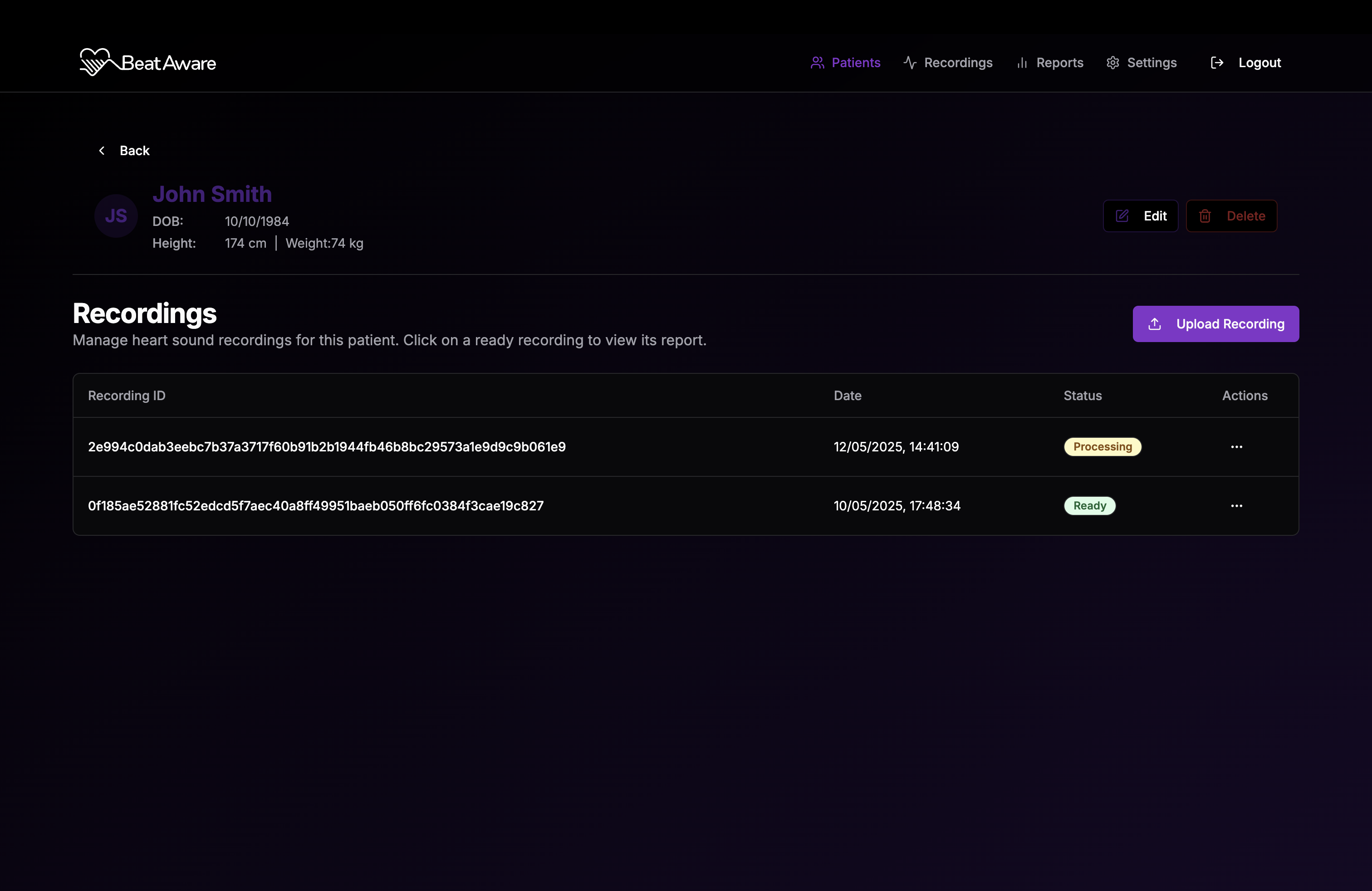 Patient recordings page showing a list of heart sound recordings with their status